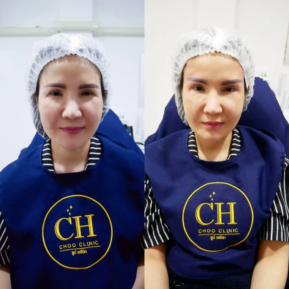 Choo clinic,ชูว์ คลินิกสาขา สมุทรสาคร