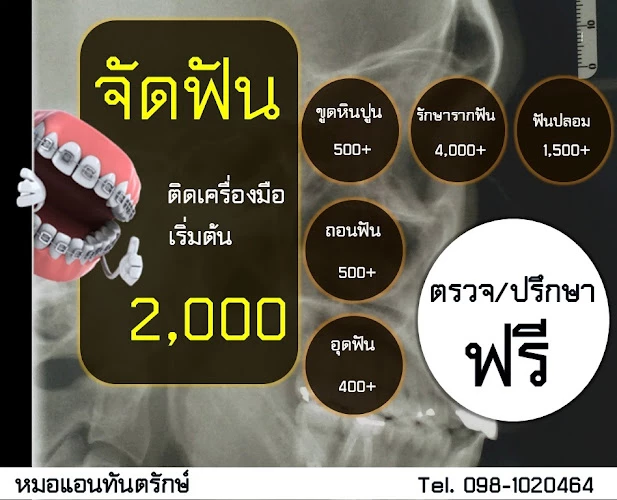 คลินิกทันตกรรมหมอแอนทันตรักษ์ สาขาอุบล (ซอยบ่อนไก่)