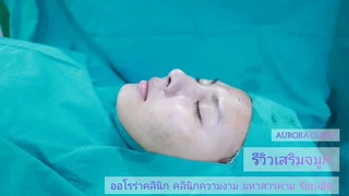 AURORA CLINIC ออโรร่าคลินิก คลินิกความงาม ร้อยเอ็ด