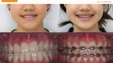 ทำฟัน จัดฟัน วีเนียร์ เชียงใหม่ M.Square Dental Care - Chiang Mai Dental Esthetic Center