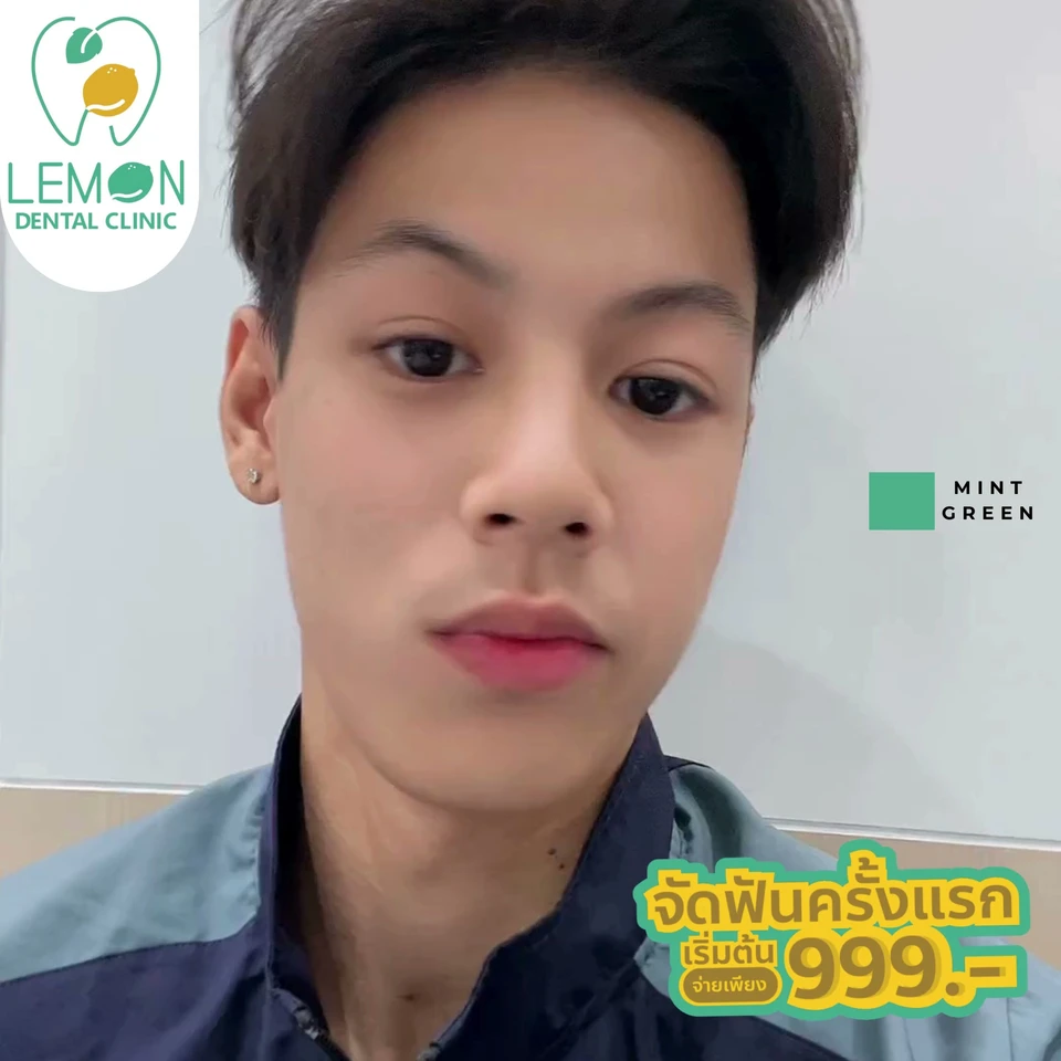 LEMON Dental Clinic (สาขาบางใหญ่ซิตี้) จัดฟัน ทำฟัน - เลมอน คลินิกทันตกรรม