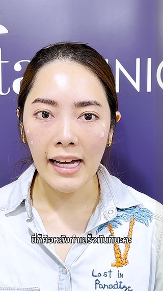 Atita Clinic อทิตาคลินิก (สาขาซีคอนสแควร์ศรีนครินทร์)