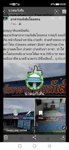 นวดรักษาแก้เส้นโดยตรง