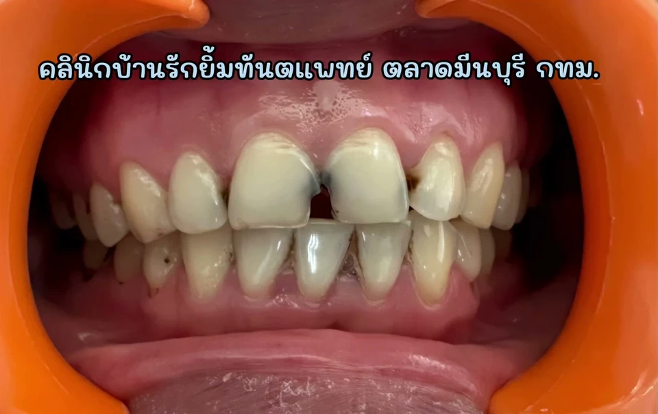 คลินิกบ้านรักยิ้มทันตแพทย์