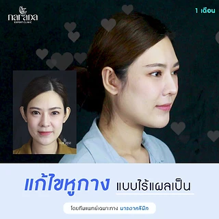 Narada Clinic นารดาคลินิก เจ็ดยอด-ศูนย์แสดงสินค้า นานาชาติ