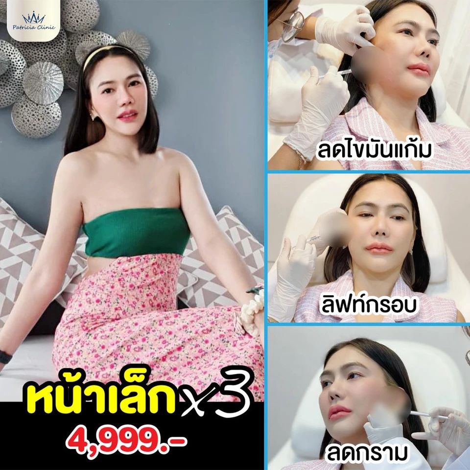 แพทริเซียคลินิก เพชรบุรี บ้านแหลม โบท็อกซ์ ร้อยไหม ฟิลเลอร์ วิตามิน