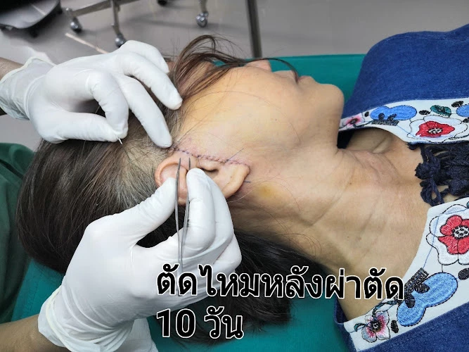 คลีนิคสุขุมวิทศัลยกรรมตกแต่ง