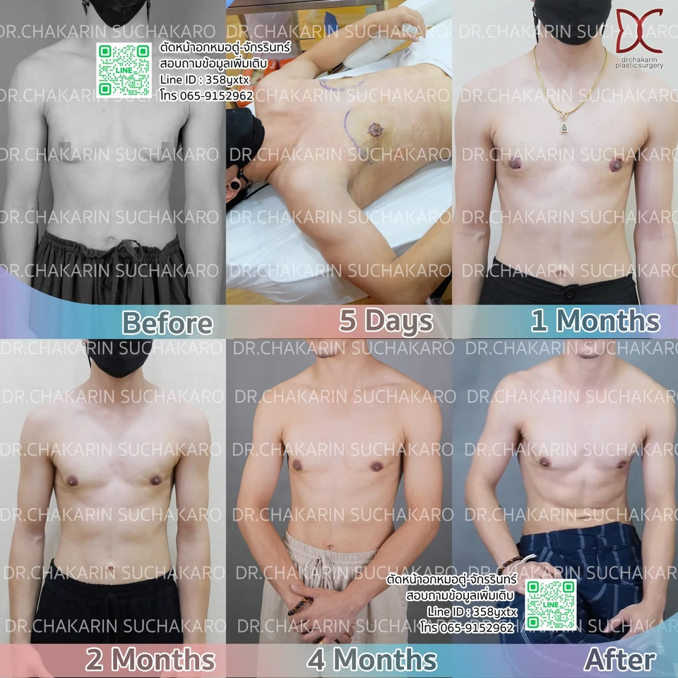 Dr.Chakarin Plastic & Reconstructive Surgery Thailand